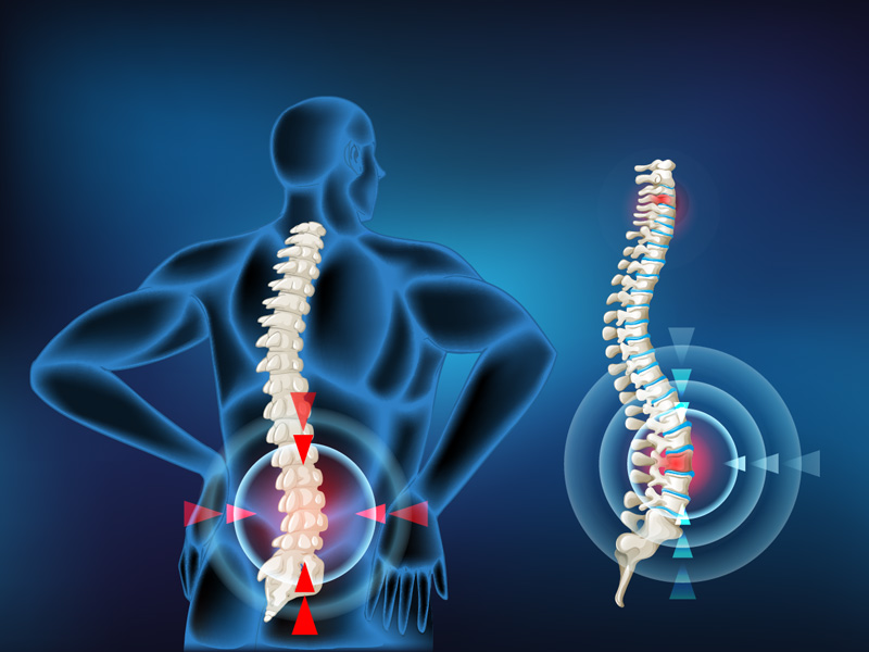 Thrissur Medical College also offers the latest surgery to correct curvature of the spine