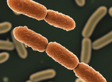 Kakkanad DLF Flat: Presence of coliform bacteria in samples tightens Public Health Act